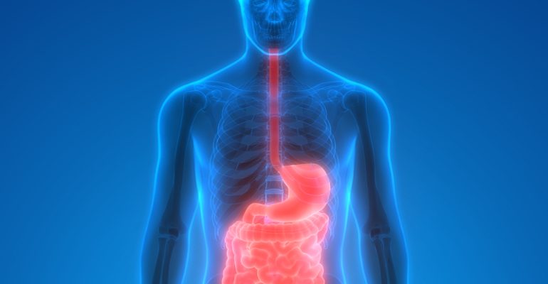3d X-ray of the gut image