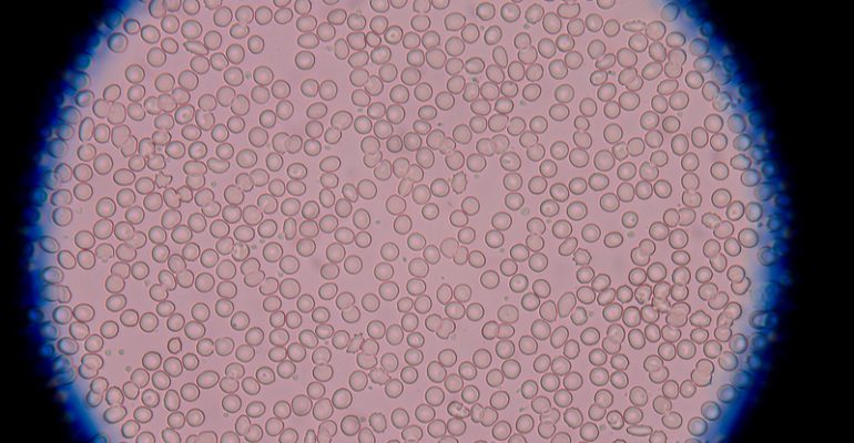 image of blood cells under a microscope
